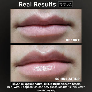 Revision Skincare YouthFull Lip Replenisher® 0.33 oz.